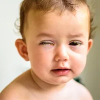 inflammation-de-lorbite