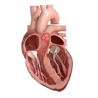 insuffisance-tricuspidienne