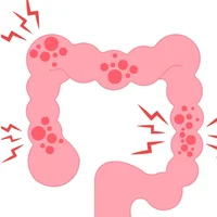 maladie-de-hirschsprung