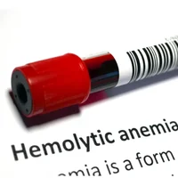 maladie-hemolytique-du-nouveau-ne