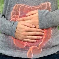 malrotation-intestinale