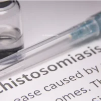 schistosomiase