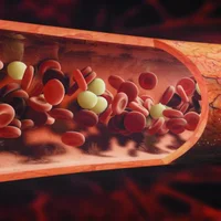 septicemie-et-choc-septique