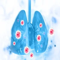 tuberculose-bacterienne-tb