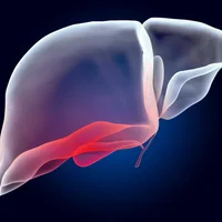 adenome-hepatocellulaire