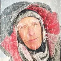 engelures-erytheme-pernio